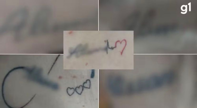 Dentista é preso suspeito de manter companheira em cárcere privado e forçá-la a fazer 10 tatuagens com o seu nome