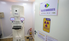 Cirurgias plásticas de mama pelo SUS crescem 54% em dez anos