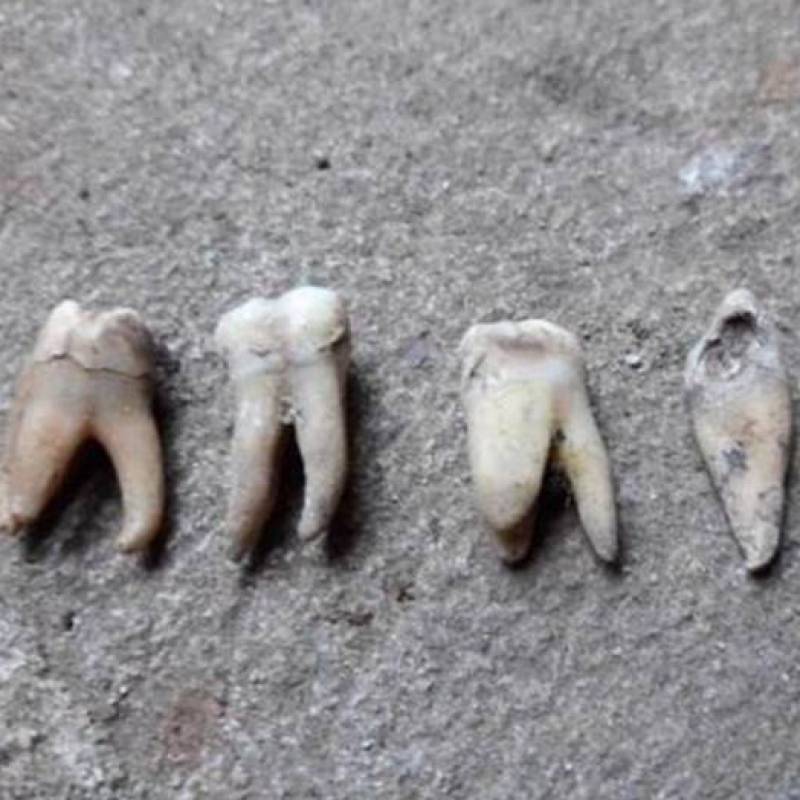 Dentes humanos encontrados em frigorífico desativado em Ibirubá podem ter ligação com túnel nazista