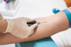 Colesterol alto aumenta risco de infarto e AVC, alerta cardiologista do HCI