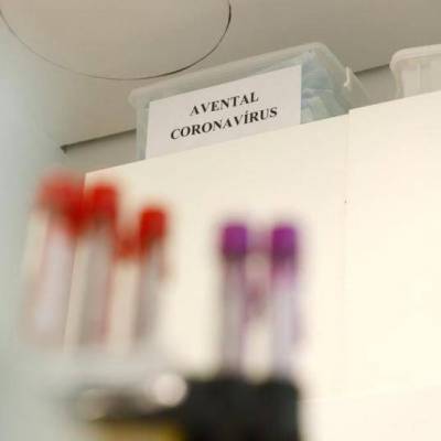 Rio Grande do Sul tem 24 casos suspeitos de coronavírus