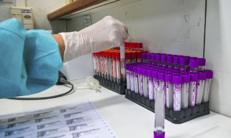 Universidade brasileira desenvolve teste sorológico 20 vezes mais barato